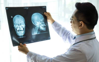 Première mondiale : une tumeur au cerveau retirée avec l’aide de l’IA
